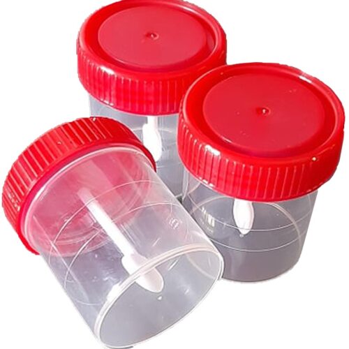 Specimen Container ( Stool ), with Label, with Spoon Non-Sterile, 60mL, 100pcs