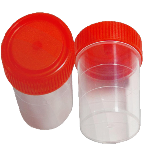 Specimen Container, (Urine), Screw Cap Non-Sterile, 60mL, 100pcs